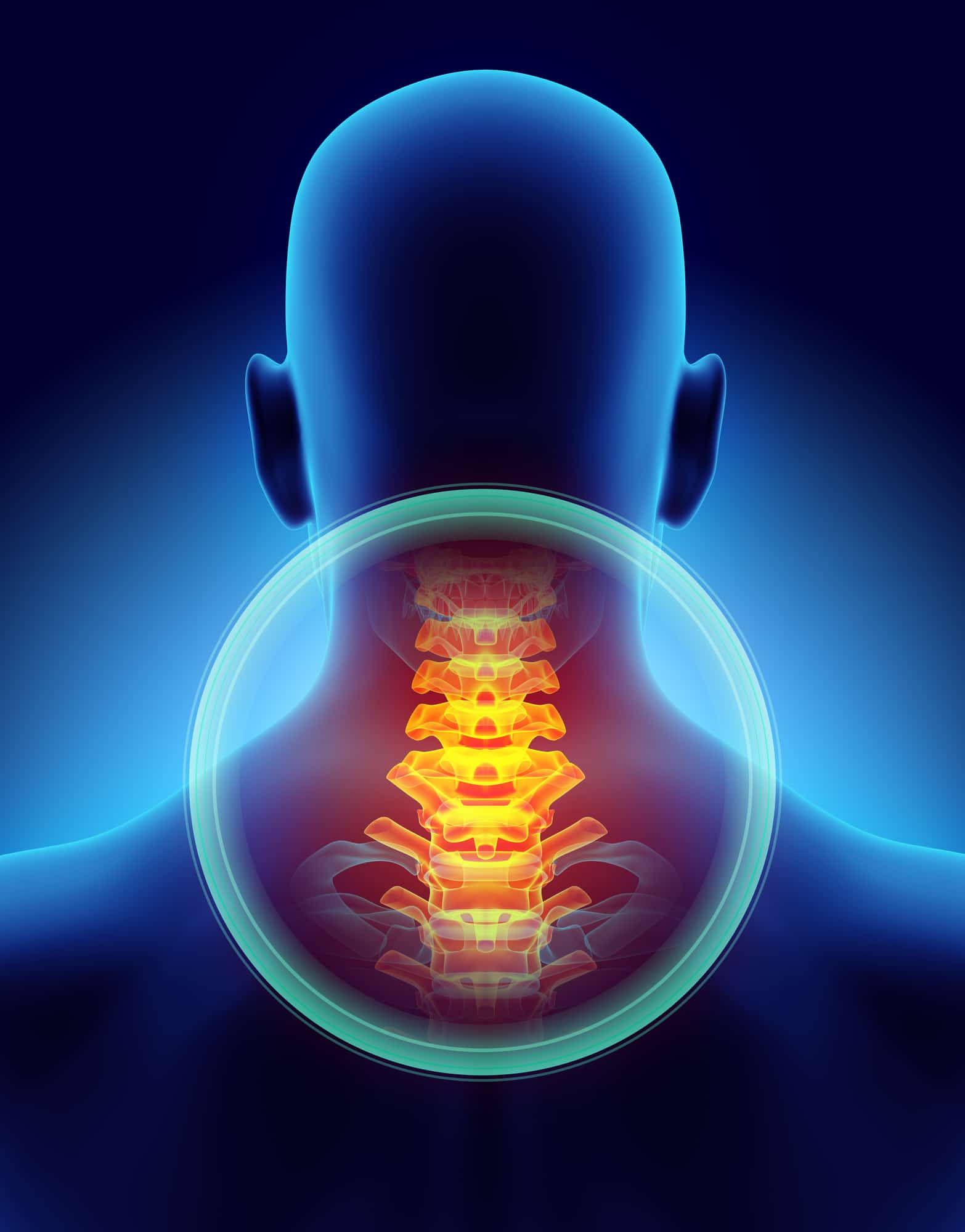 Neck Pain