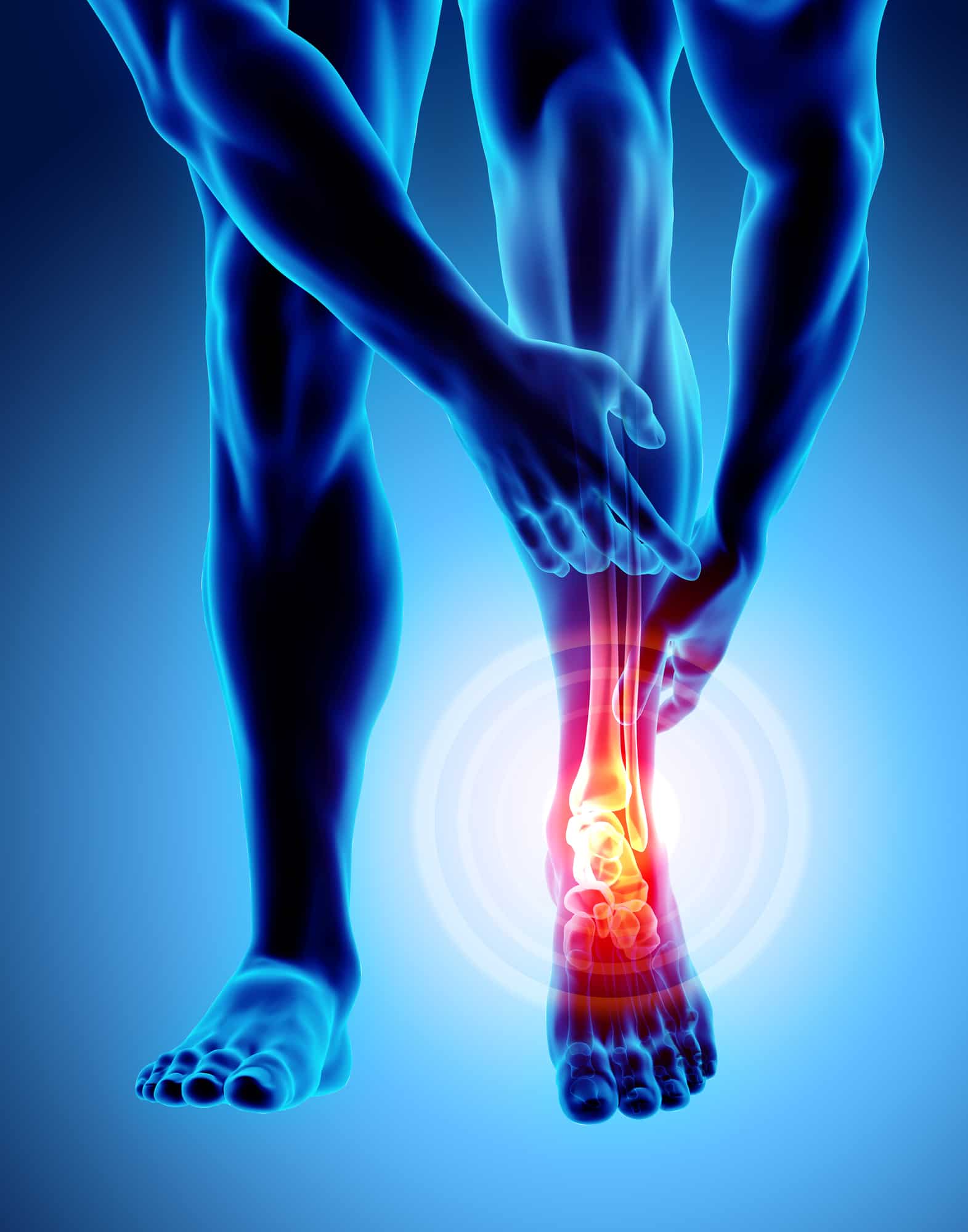 Foot Pain