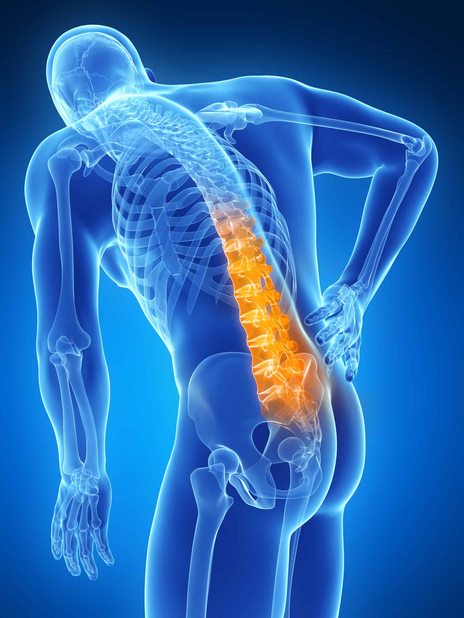 Back Pain